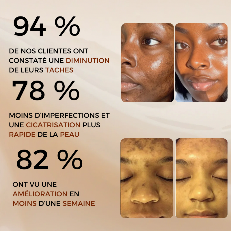 Savon anti tâches noires / Quintaux